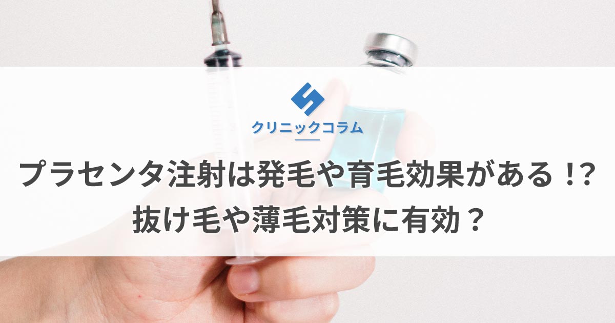 プラセンタ注射は発毛や育毛効果がある！？抜け毛や薄毛（ハゲ）対策に有効？【医師監修】