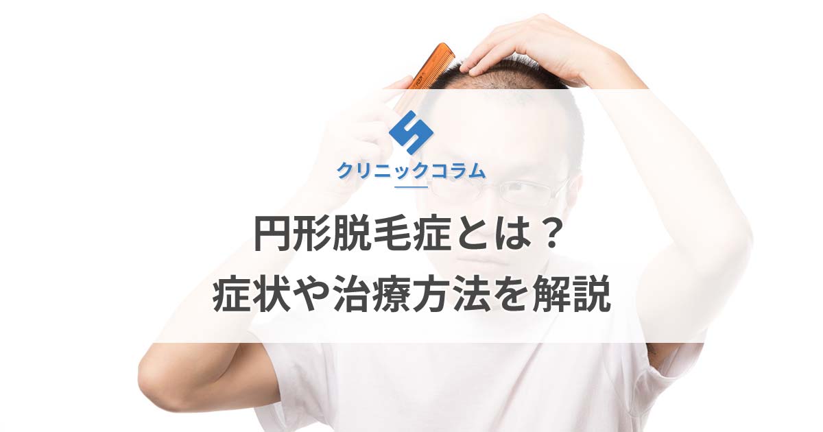 円形脱毛症とは？症状や治療方法を解説【医師監修】