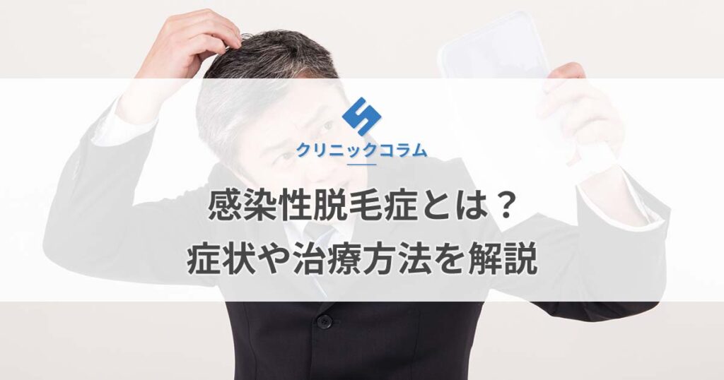 感染性脱毛症とは？症状や治療方法を解説【医師監修】